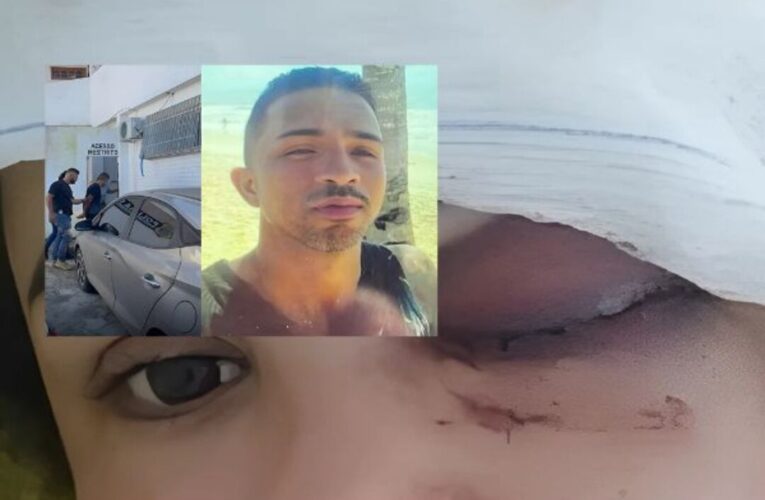 Agressor de mulher em Teixeira de Freitas é capturado: Vítima ficou cega de um olho.